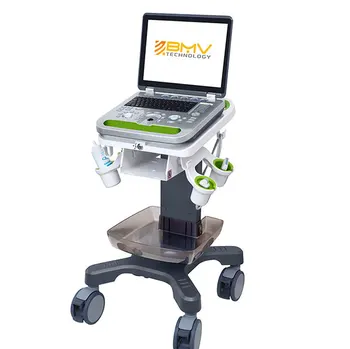 Hopsital Klinike 3D 4D farebný doppler Ultrasond skenera Zariadenia, notebook, light-weight diagnóza starostlivosti led monitor